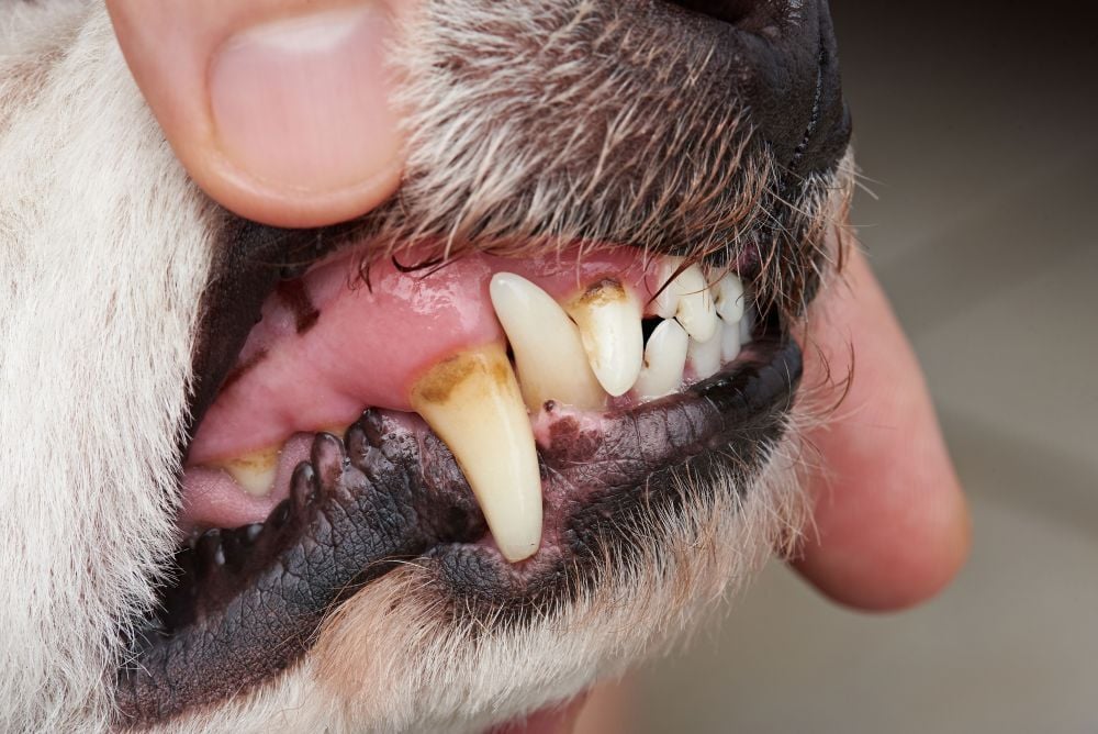 Fogkő és a fogak betegségei is okozhatnak rossz szájszagot
