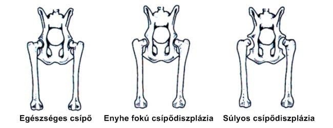 Csípődiszplázia kutyáknál - Egészséges és deformált csípő